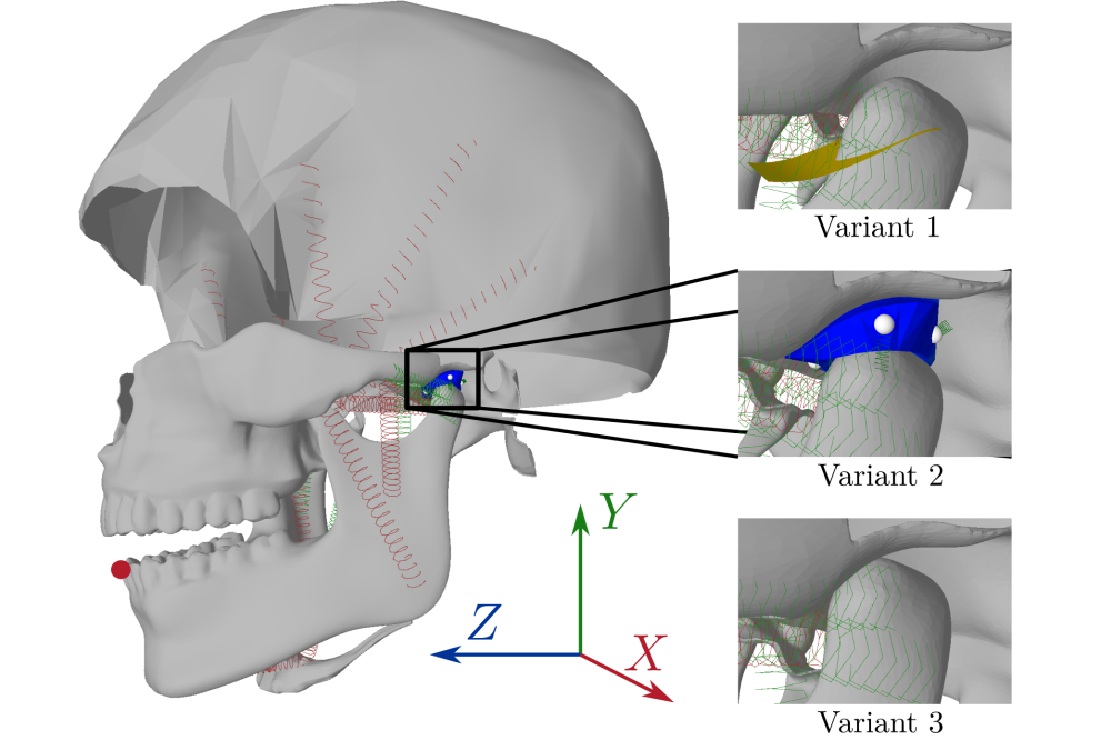 Paul-Otto Müller_Optimization of the Model Parameters and Muscle Excitations of a Human Jaw Model_Figure1