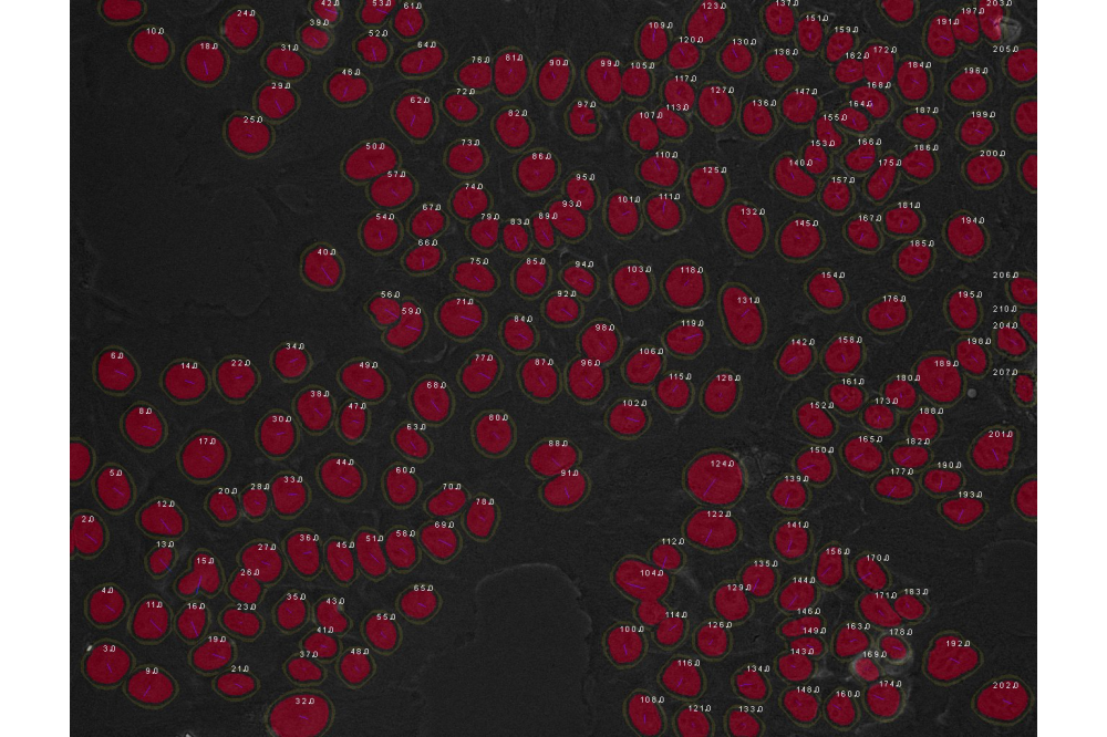 Alexander Löwer_Computer-Aided Analysis of Time-Lapse Microscopy Data_Figure1